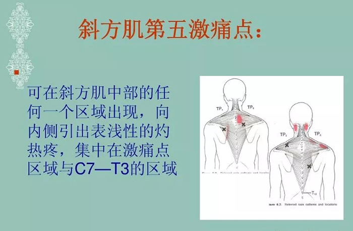 斜方肌的定位触诊与肌痛点常见问题处理 疼痛天地 国际整脊网