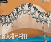 微信图片_20191223173754.gif